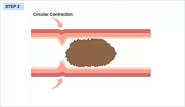 Peristalsis 2