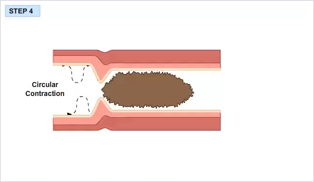 Peristalsis 4